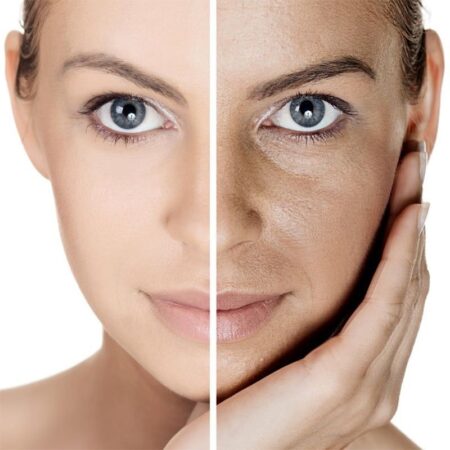 DIY Face Peels