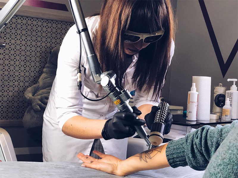 Laser Tattoos Removal
