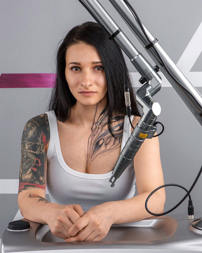 Tattoo Removal