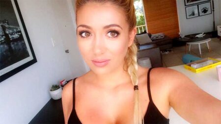 Lip Fillers
