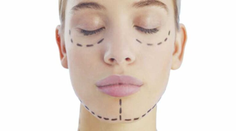 Top Reasons for Getting a Liquid Facelift