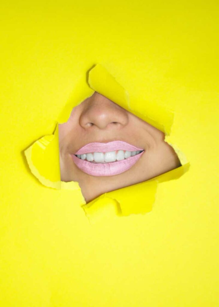 Naturally Full Lips Before Lip Injections And Fillers In Maple Ridge