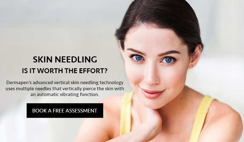 Skin Needling: Is it Worth the Effort?