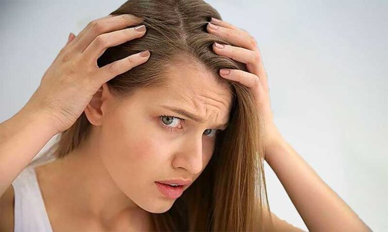Treating female pattern hair loss
