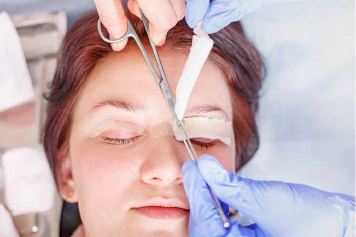 Tips for Blepharoplasty Recovery