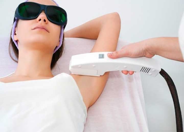 Considering Laser Hair Removal