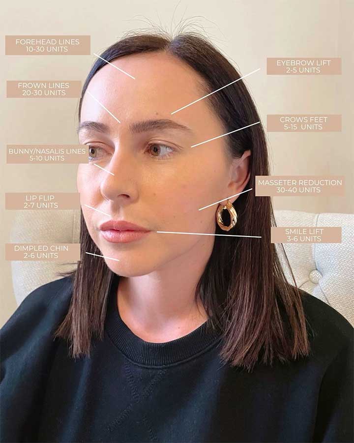 Why Botox Should Be Part Of Your Beauty Routine