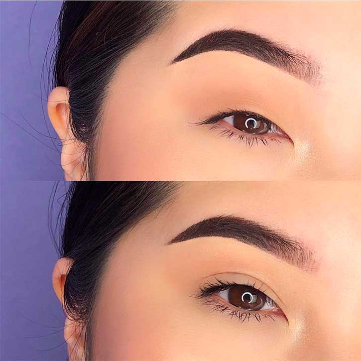 Eyelid Tape Gives Asian Women Creases And Double Eyelids