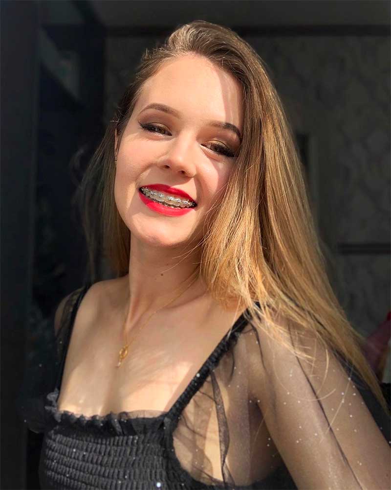 Braces for Adults