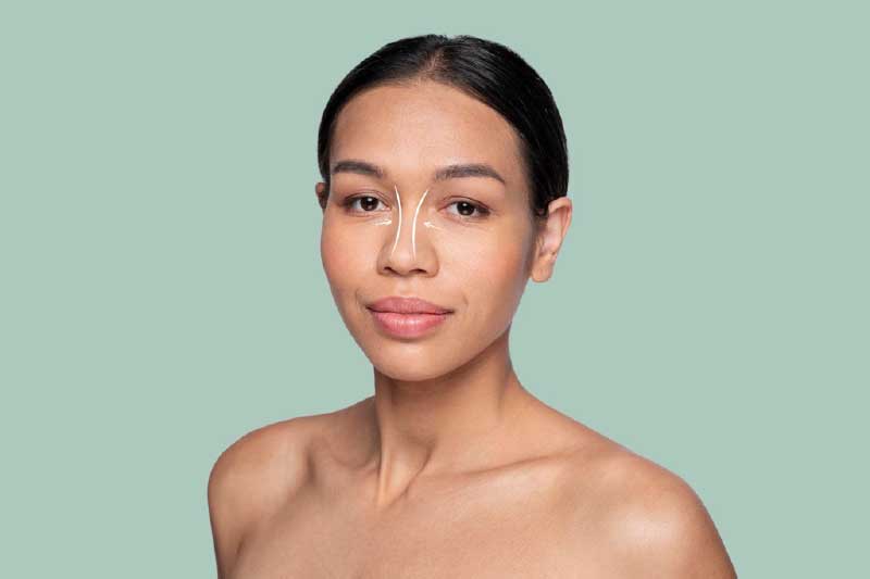 What To Avoid After Receiving Rhinoplasty?