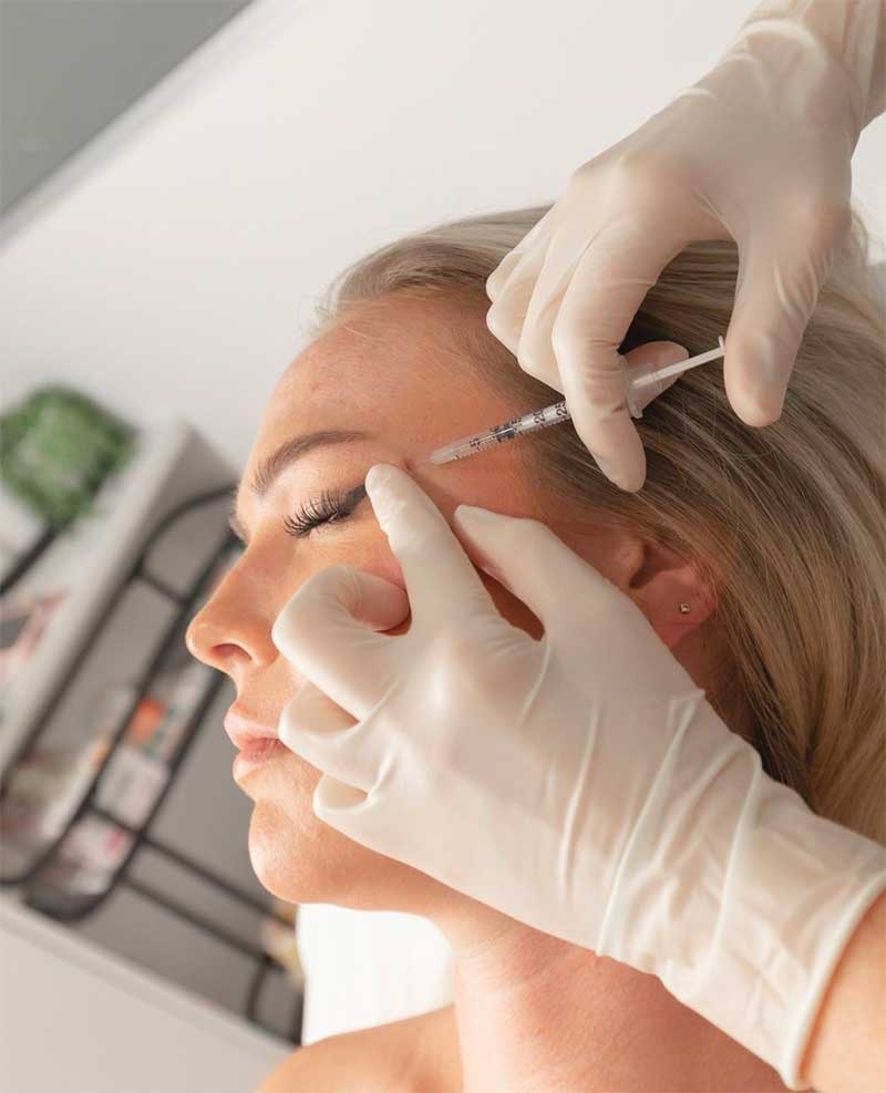How do Dermal Fillers Work?