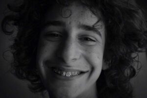 10 Things to Consider Before Getting Braces Things to Consider Before Getting Braces