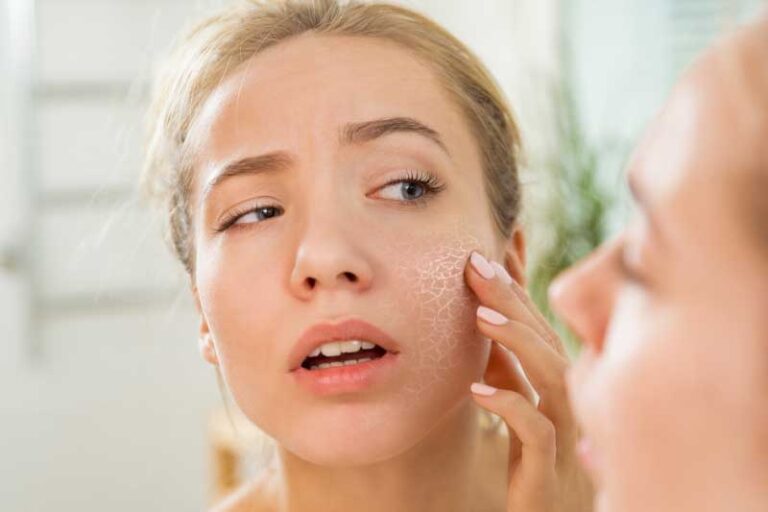 How To Keep Your Dry Skin Hydrated