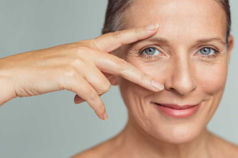 How to Reduce and Prevent Crow's Feet