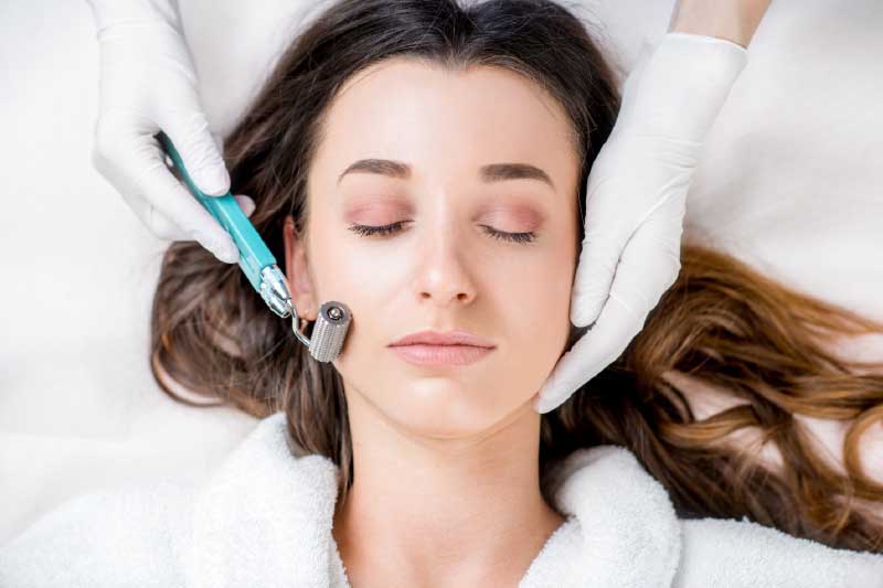 5 Rewarding Benefits of Microneedling