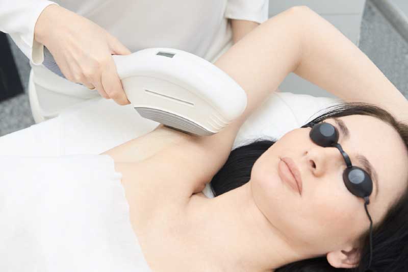 3 Hair Removal Methods Everyone Should Consider