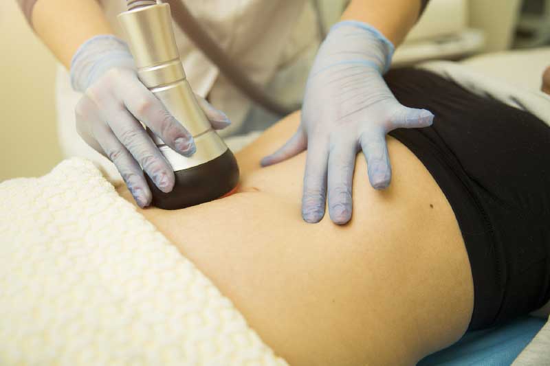 Laser Liposuction vs Coolsculpting: What Are the Differences?
