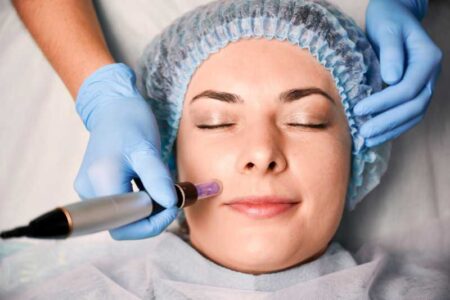 What To Expect In A Microneedling Procedure