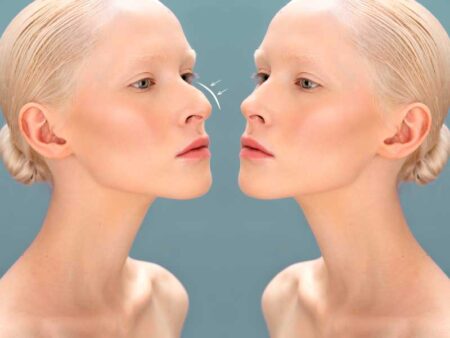 woman before and after surgery