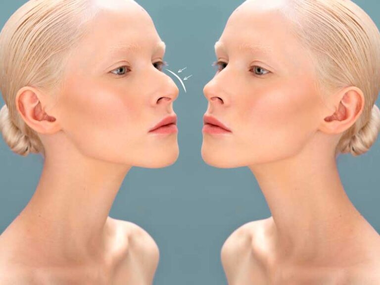 woman before and after surgery