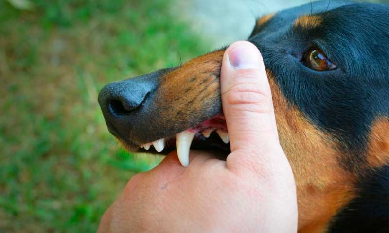​​7 Injuries You Could Sustain Due to a Dog Attack