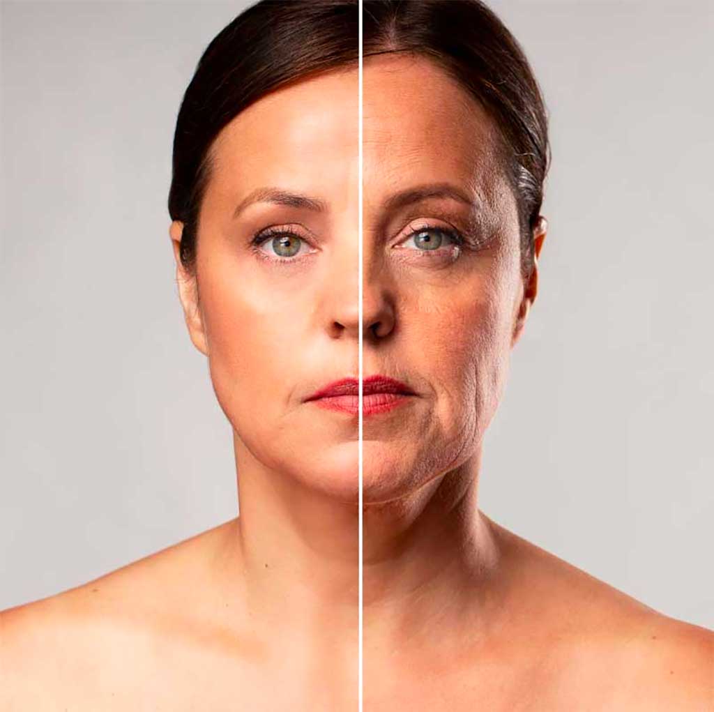 What is meant by the premature skin aging process?