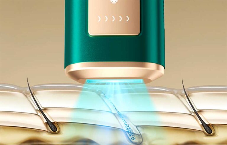 How Often Should You Use IPL Hair Removal at Home?