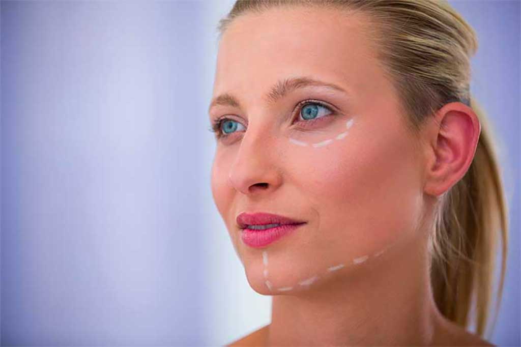 Tips for Faster Recovery from a Facial Plastic Surgery Procedure