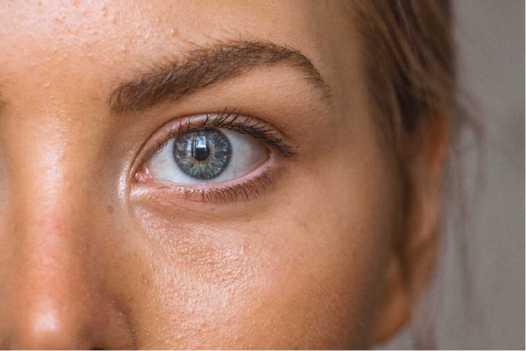 The Ultimate Guide to The Ultherapy Process