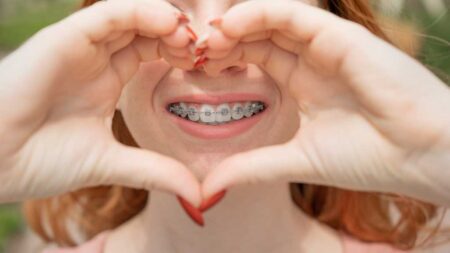 9 Ways To Turn Your Braces Into A Fashion Statement