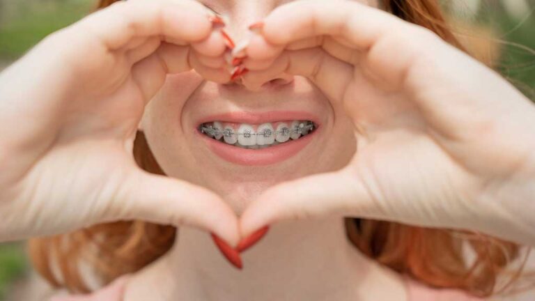 9 Ways To Turn Your Braces Into A Fashion Statement