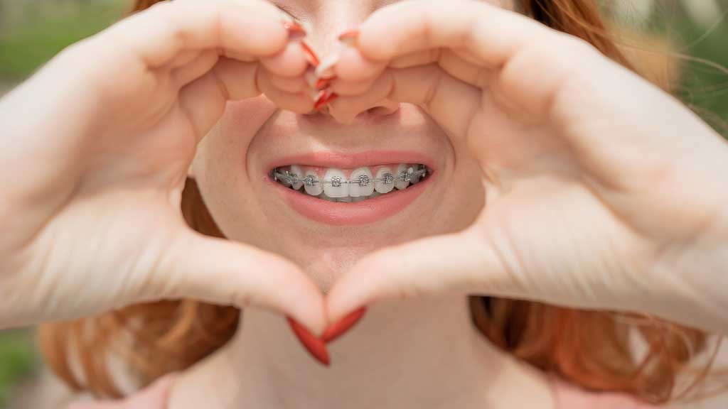 9 Ways To Turn Your Braces Into A Fashion Statement