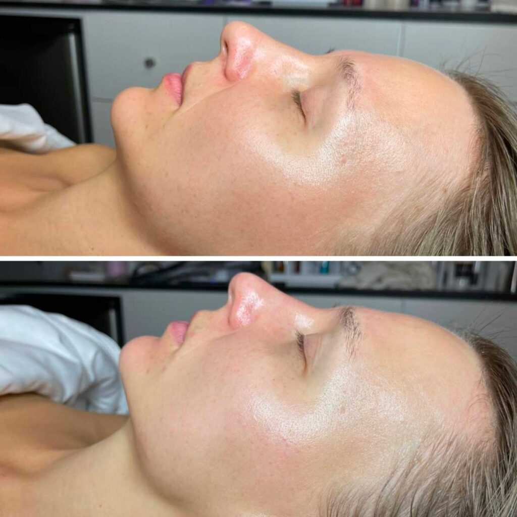 Citadels of Charm: Elevating Salons with JetPeel Fortifications