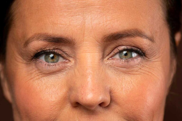 Smooth Away Wrinkles with Dysport in Vancouver