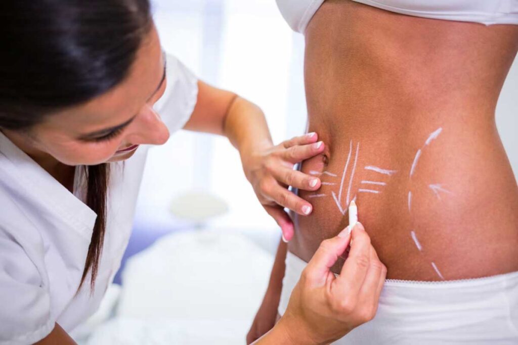 The Role of Liposuction in Reshaping Body Areas