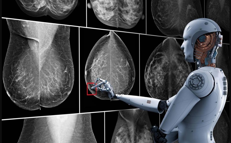 Artificial Intelligence and Breast Cancer Screening