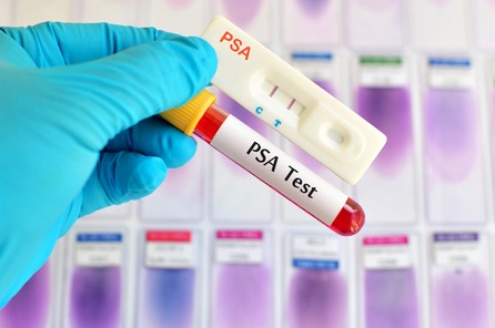 PSA test