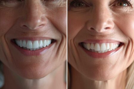 Reviving Your Smile: The Transformative Power of Dental Implants