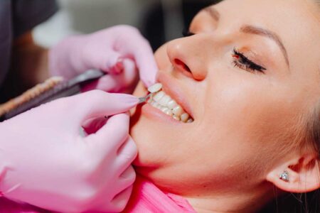 Aesthetic Elegance: Unveiling the Beauty of Porcelain Veneers