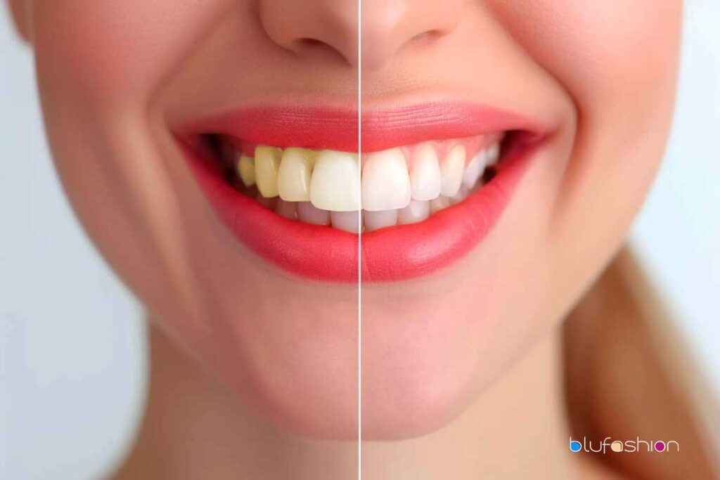 Smile Brighter: Boost Your Radiance with Carbamide Peroxide