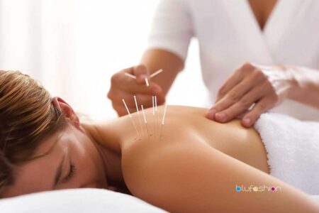 I Tried It & Here’s the Top 10 Benefits of Acupuncture