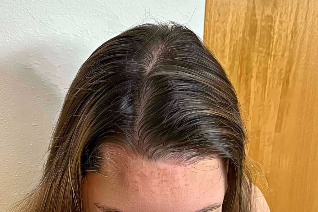 Hair Fall Serums: How To Choose & Use Them For Visible Results