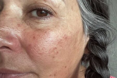close-up photograph of the left side of a middle-aged woman's face