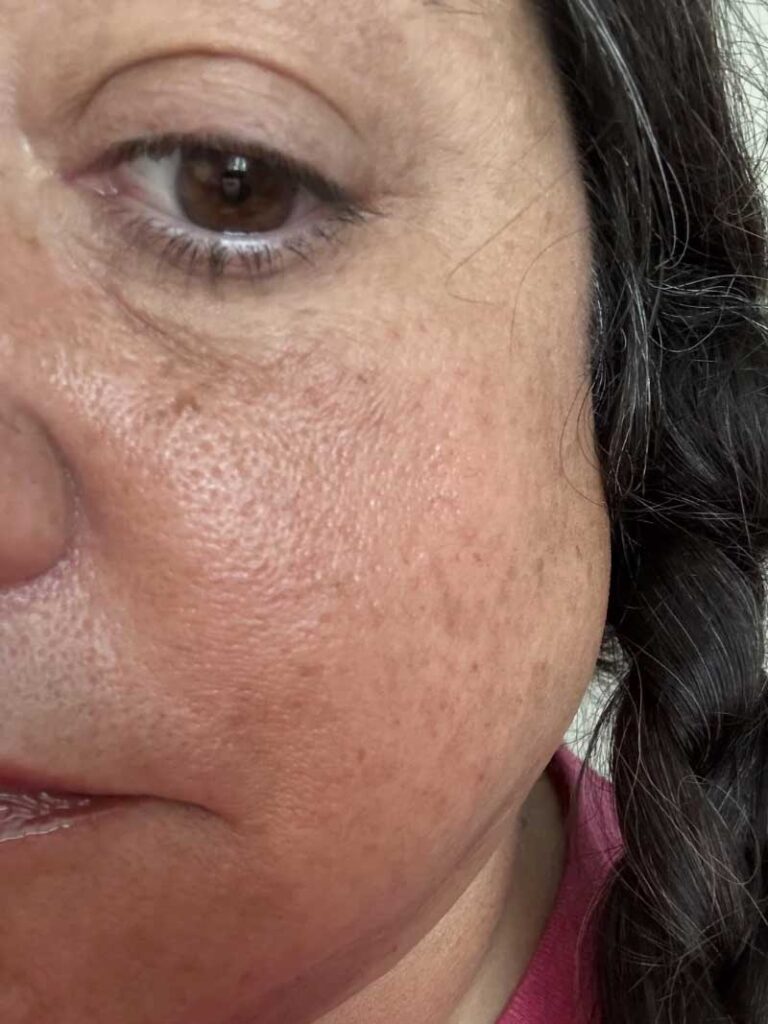 What Your Skin Is Really Saying When It Turns Brown