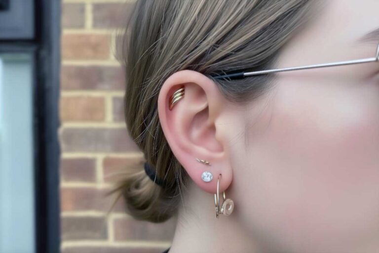 Double coinslot ear mod, a clear guide from first consult to healed