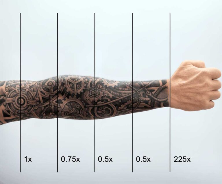 Things You Should Know About Laser Tattoo Removal